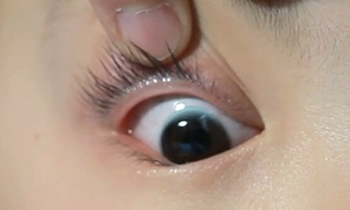 把隐形眼镜清洗器上下戴反了是什么觉得